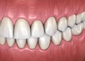 what is bite solgem z